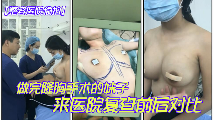整容医院偷拍做完隆胸手术的妹子来医院复查前后对比这医生的手艺还真不错